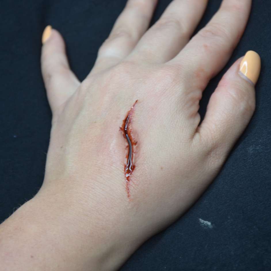 bleeding scar